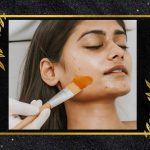 Understanding Melasma and the Role of Chemical Peels