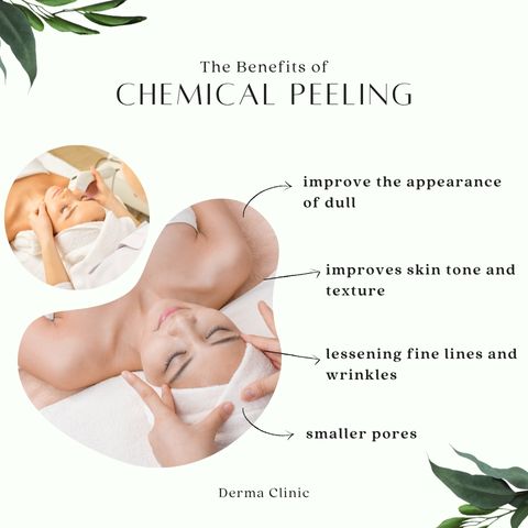 Chemical Peeling