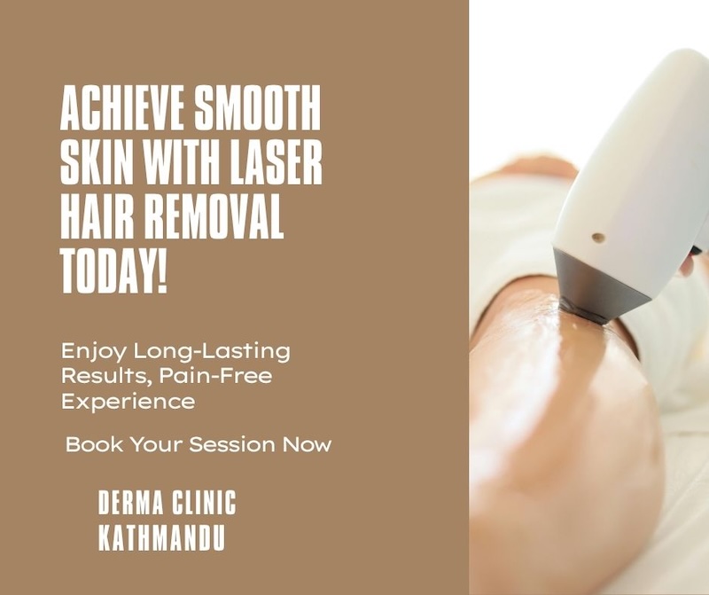 Laser Hair Removal