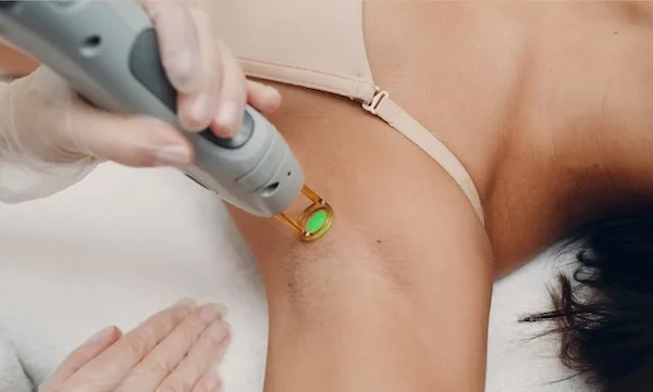 Laser Hair Removal in Derma Clinic