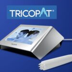 Tricopat Treatment :The Science-Backed, Painless Solution for Hair Loss. Does it Work?