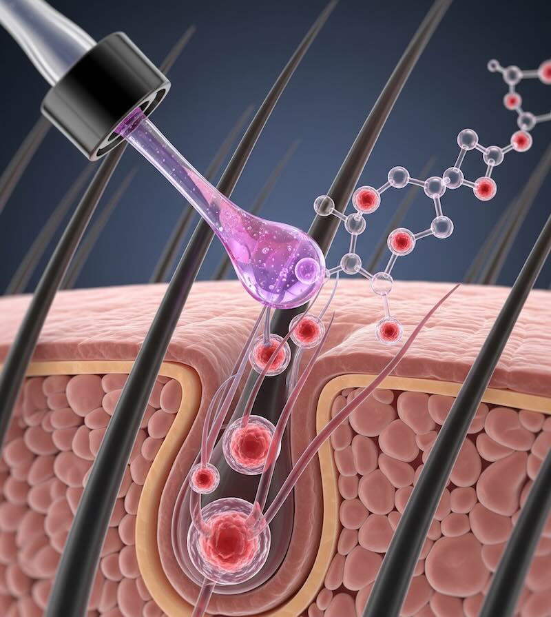PP405 for Hair Growth