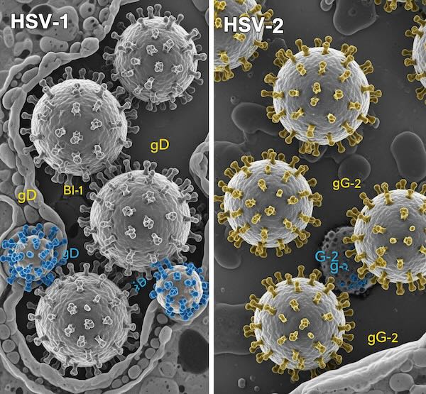 Genital HSV-1 vs HSV-2: Recurrence, Treatment & Pregnancy Facts
