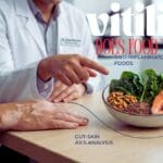 Vitiligo Diet: Foods to Avoid, Best Foods to Eat, and What Your Dermatologist Actually Wants You to Know