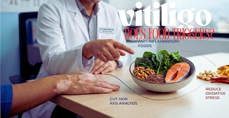 Dermatologist reviewing the best foods to avoid with vitiligo alongside anti-inflammatory, antioxidant-rich foods for melanocyte protection.